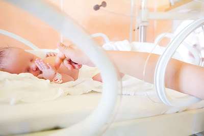 Retinopatia da prematuridade